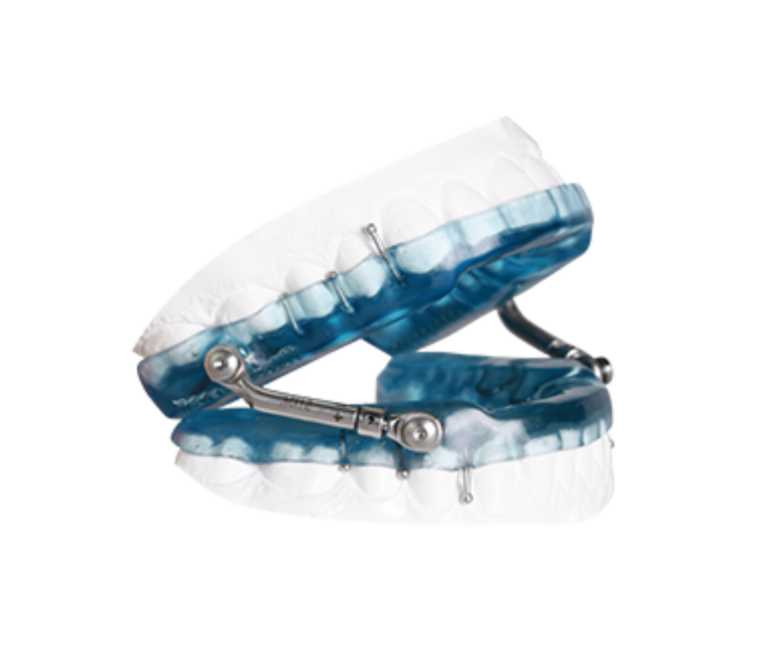OASYS Herbst Oral Appliance | Sleep Better Apnea Therapy