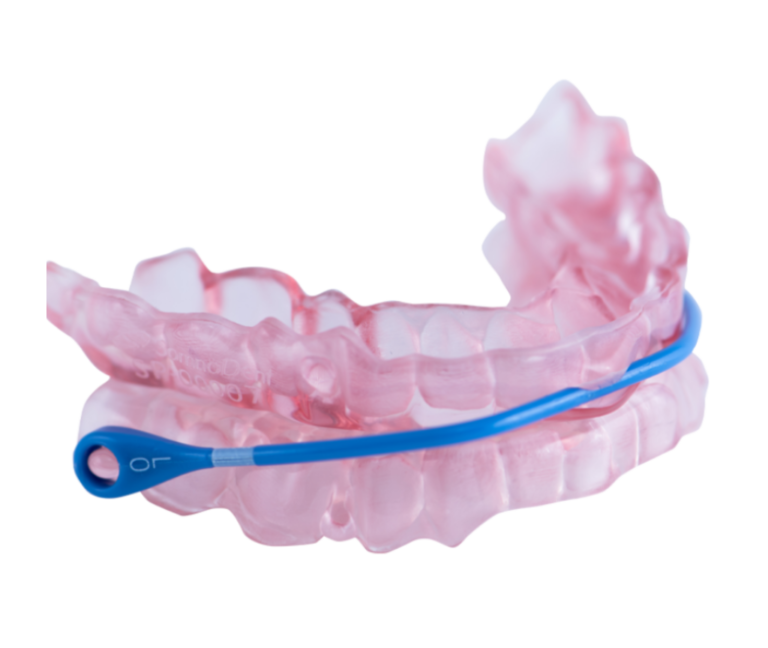 SomnoDent Oral Appliance | Sleep Better Apnea Therapy