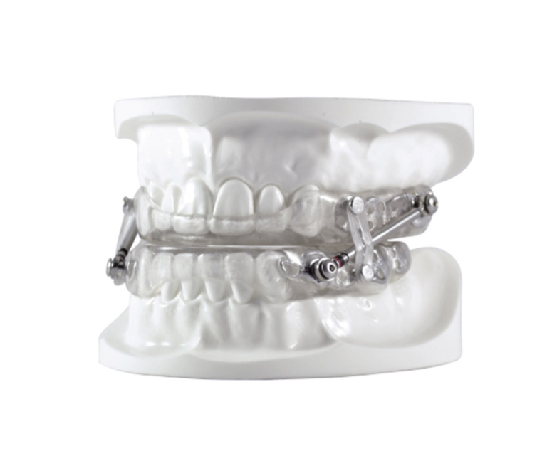 SomnoDent The SUAD Oral Appliance | Sleep Better Apnea Therapy