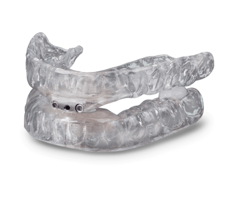 TAP Oral Appliance | Sleep Better Apnea Therapy