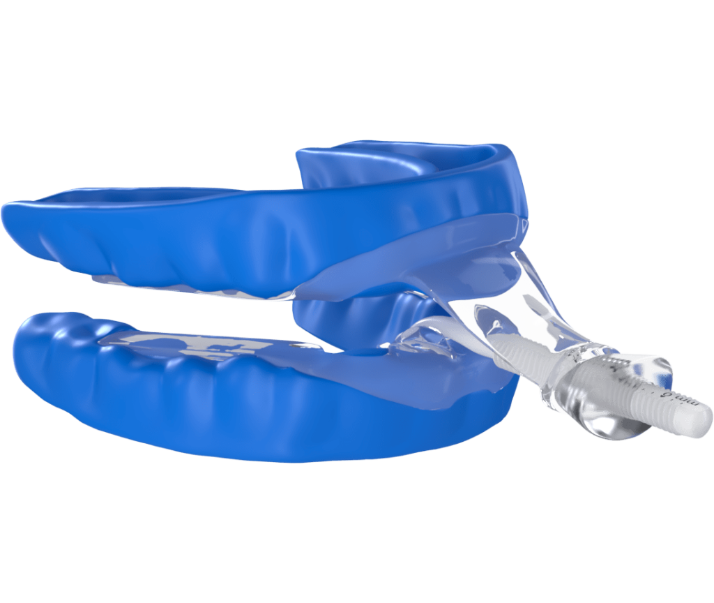 flexTAP Oral Appliance | Sleep Better Apnea Therapy